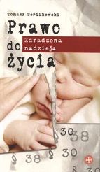Prawo do życia